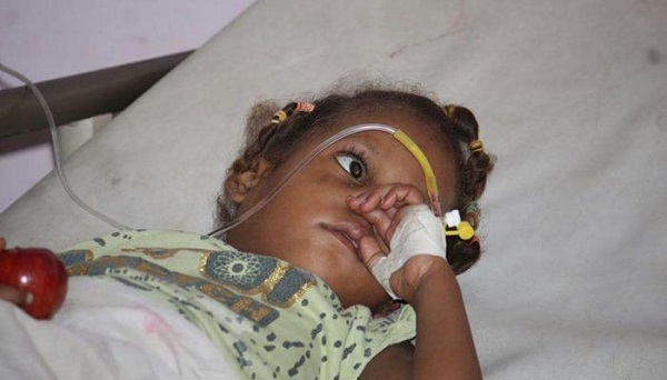أنقذوا الأطفال: تضاعف عدد مصابي الكوليرا في اليمن هذا العام